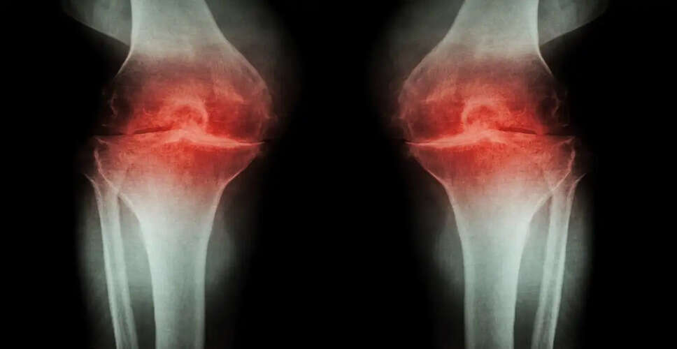 Stress and Anxiety: Hidden Threats to Bone Health