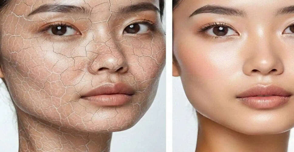 Unlock Radiant Skin: The Right Way to Apply Moisturizer