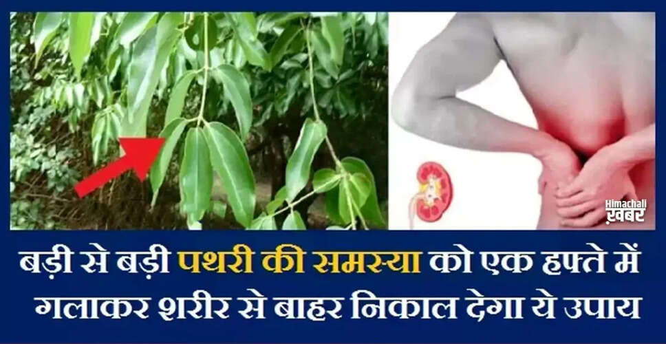 Effective Home Remedies for Kidney Stones Relief