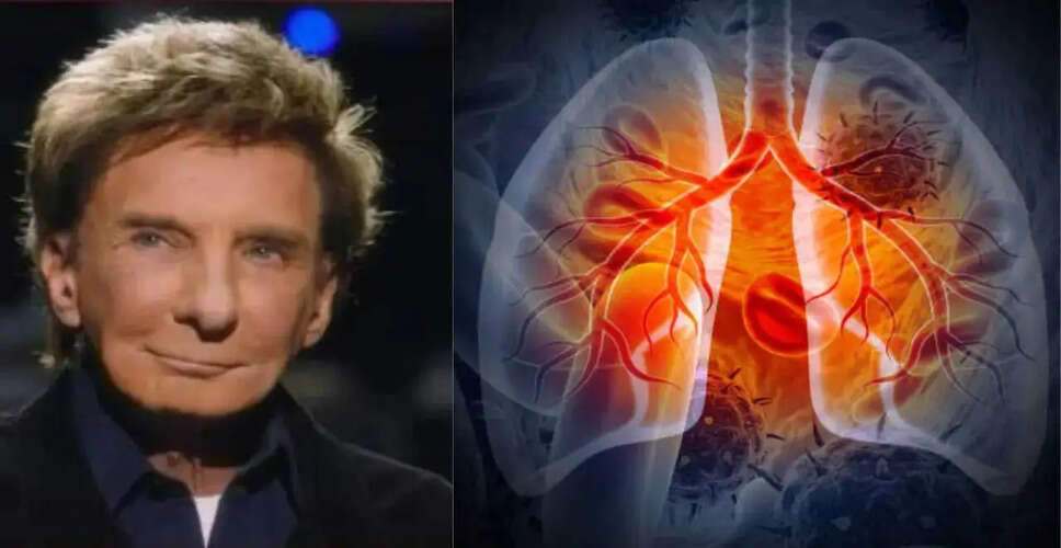 Barry Manilow Discusses His Lung Cancer Journey and Lobectomy Experience