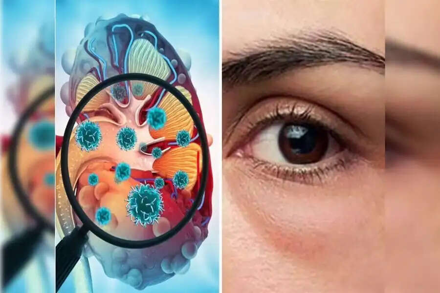 Understanding Kidney Health: Eye Symptoms You Shouldn't Ignore