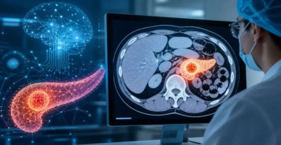 Revolutionary AI Tool Promises Early Detection of Pancreatic Cancer
