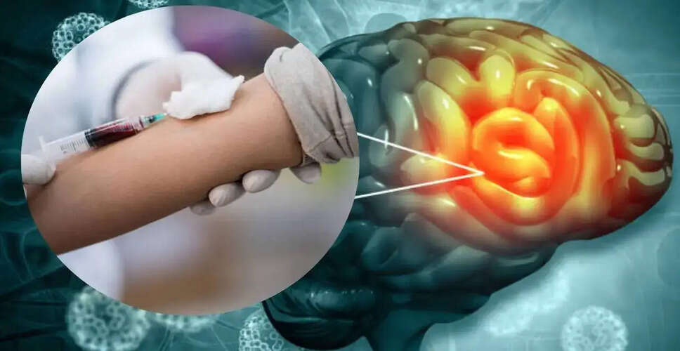 Breakthrough Blood Test for Early Detection of Brain Tumors