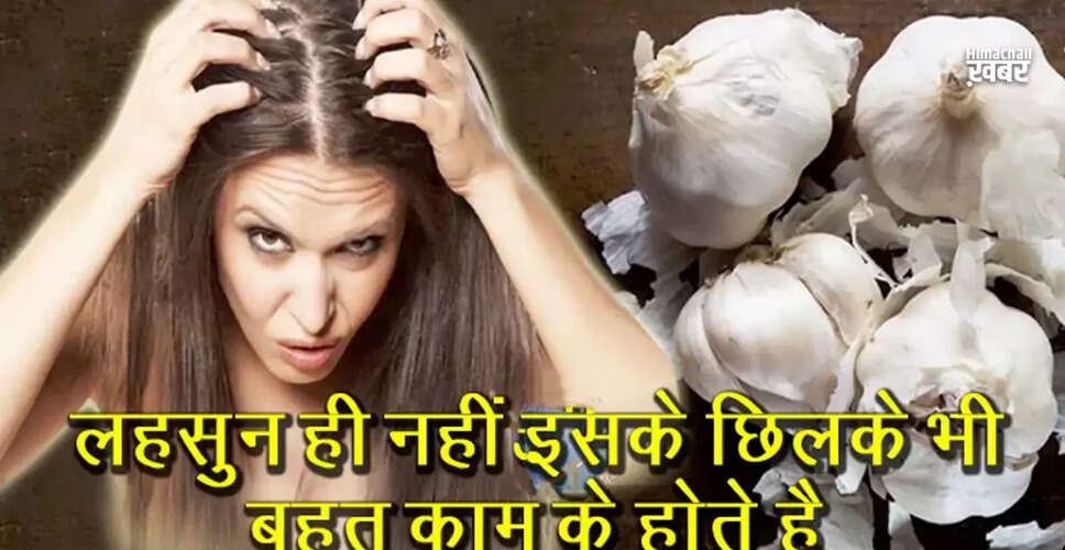 The Surprising Benefits of Garlic Peels for Health and Beauty