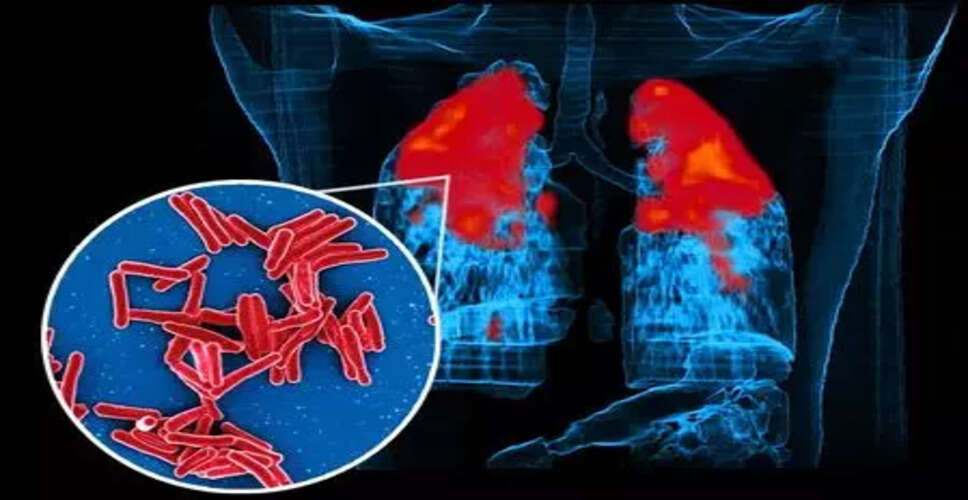 New Insights into Tuberculosis: How Bacteria Evade Antibiotics