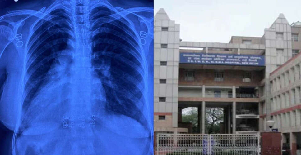 Groundbreaking Surgery in Delhi: Doctors Successfully Operate on Rare Condition