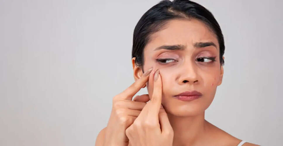 Essential Monsoon Beauty Tips for Healthy Skin and Hair