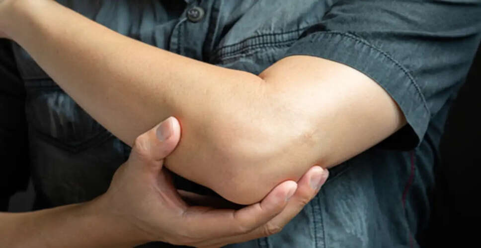 Effective Home Remedies to Lighten Dark Elbows and Knees