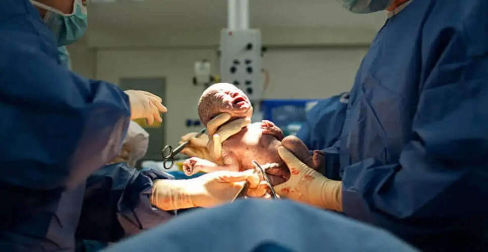 Surge in Cesarean Deliveries in India: A Closer Look at the Trends and Implications