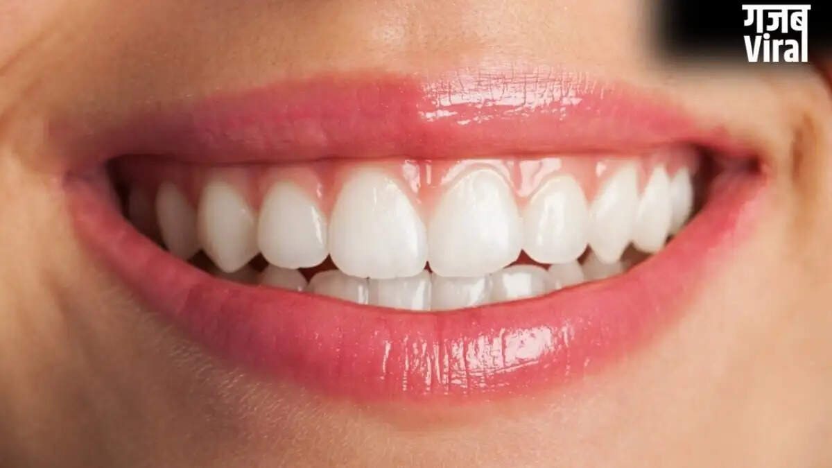 Effective Home Remedy for Whiter Teeth