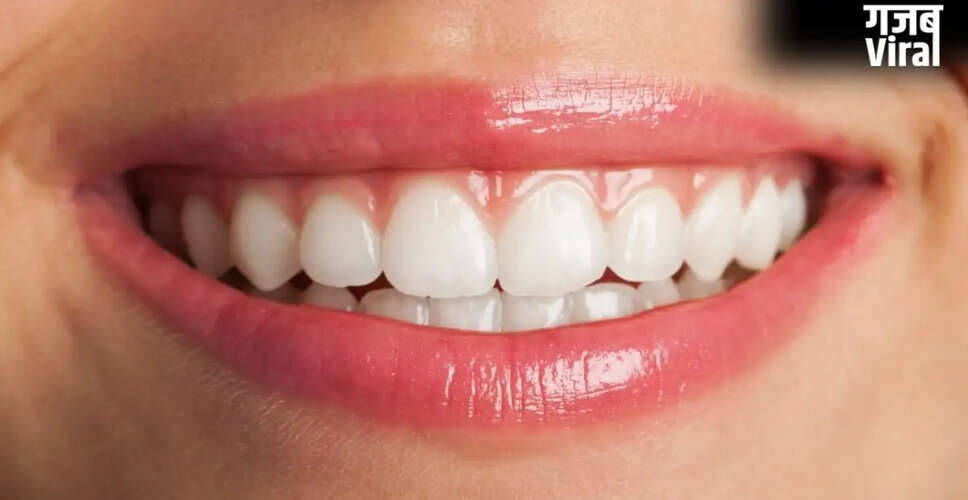 Effective Home Remedy for Whiter Teeth