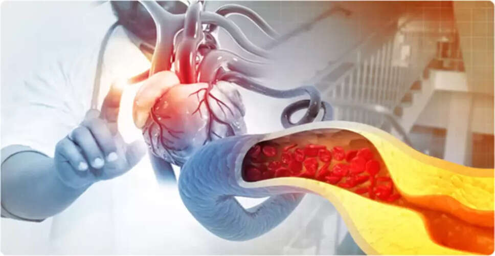 Recognizing the Hidden Signs of High Cholesterol