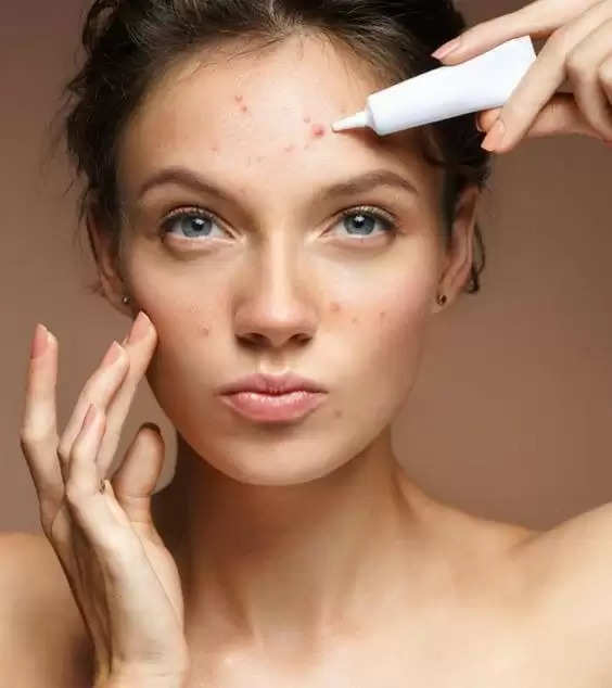 Breaking Out? Blame It on Hormones: Discover the 5 Culprits of Hormonal Acne