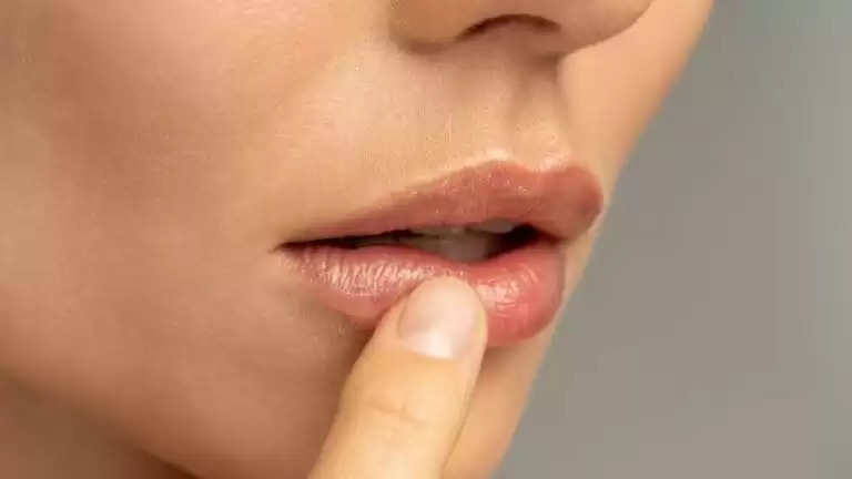 Say Goodbye to Sunburned Lips with These Simple Prevention and Treatment Techniques