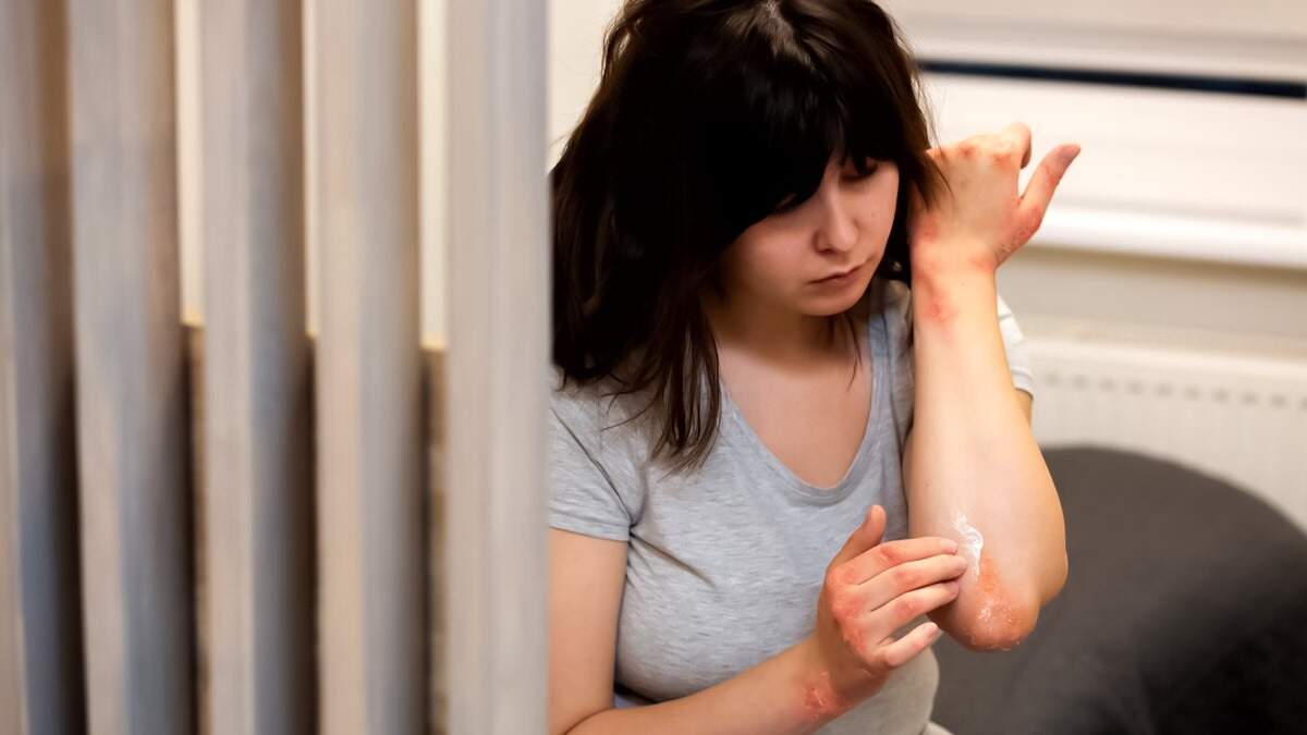 Eat Your Way to Healthy Skin: Quick Recovery Tips for Skin Injuries