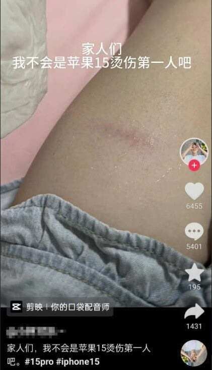 iPhone 15 Pro Heat Issues: Users Report Uncomfortable Burns