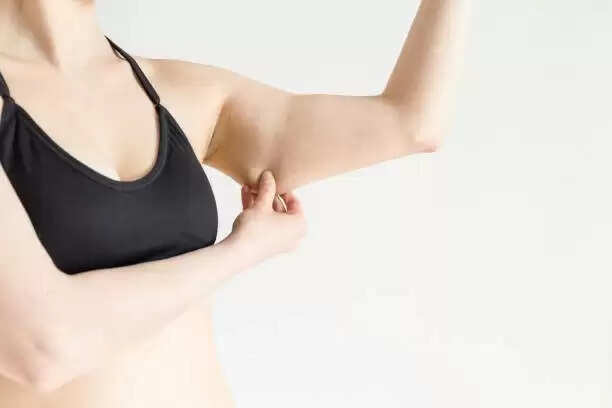 Bye-Bye Armpit Fat: Effective DIY Techniques and Exercises to Reduce Underarm Flab
