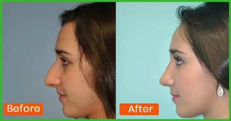 The Ultimate Nose Workout: 7 Unconventional Exercises for a Striking Nose Transformation