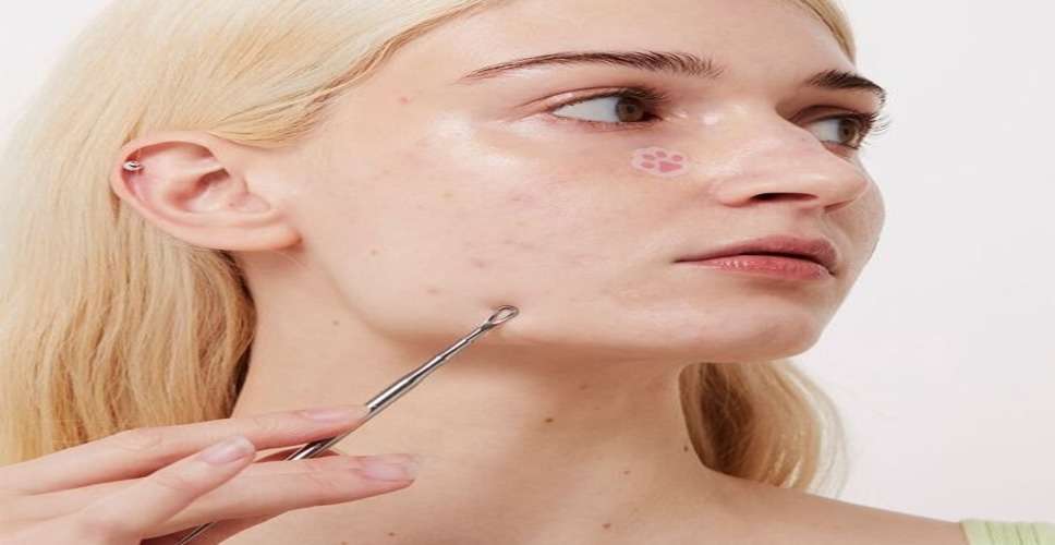 Tea Tree Treasure: 6 Easy Methods for Banishing Blackheads