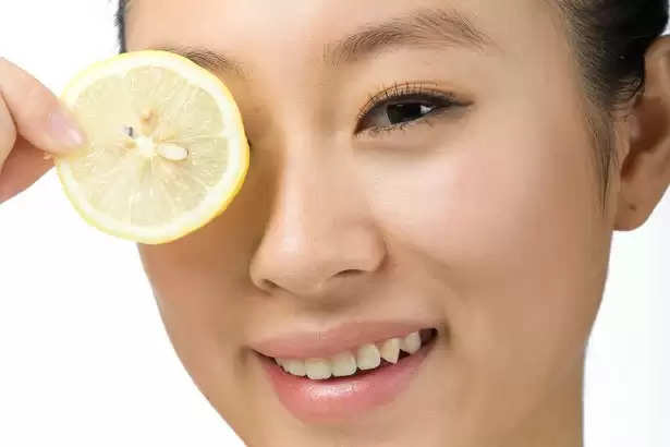 Lemon Juice for Acne and Acne Scars: A Natural Remedy Worth Trying?