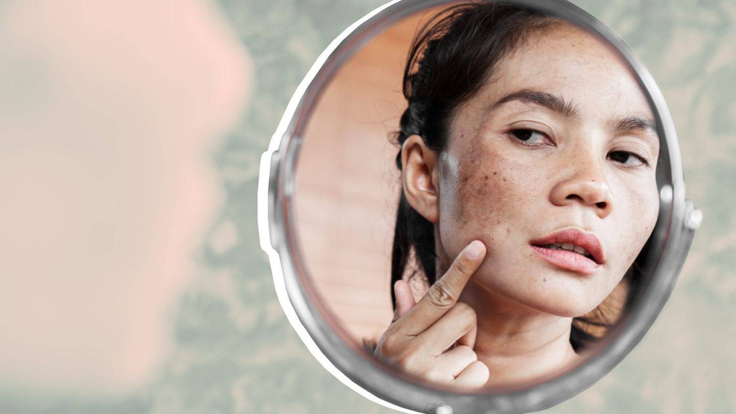 Banish Blemishes Naturally: Home Remedies to Fade Marks and Achieve Clearer Skin