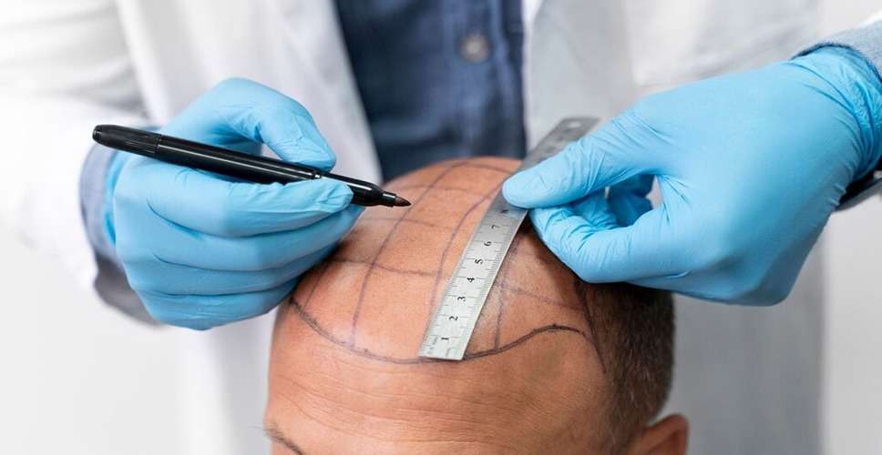The Truth About Hair Transplants: Dispelling Common Myths
