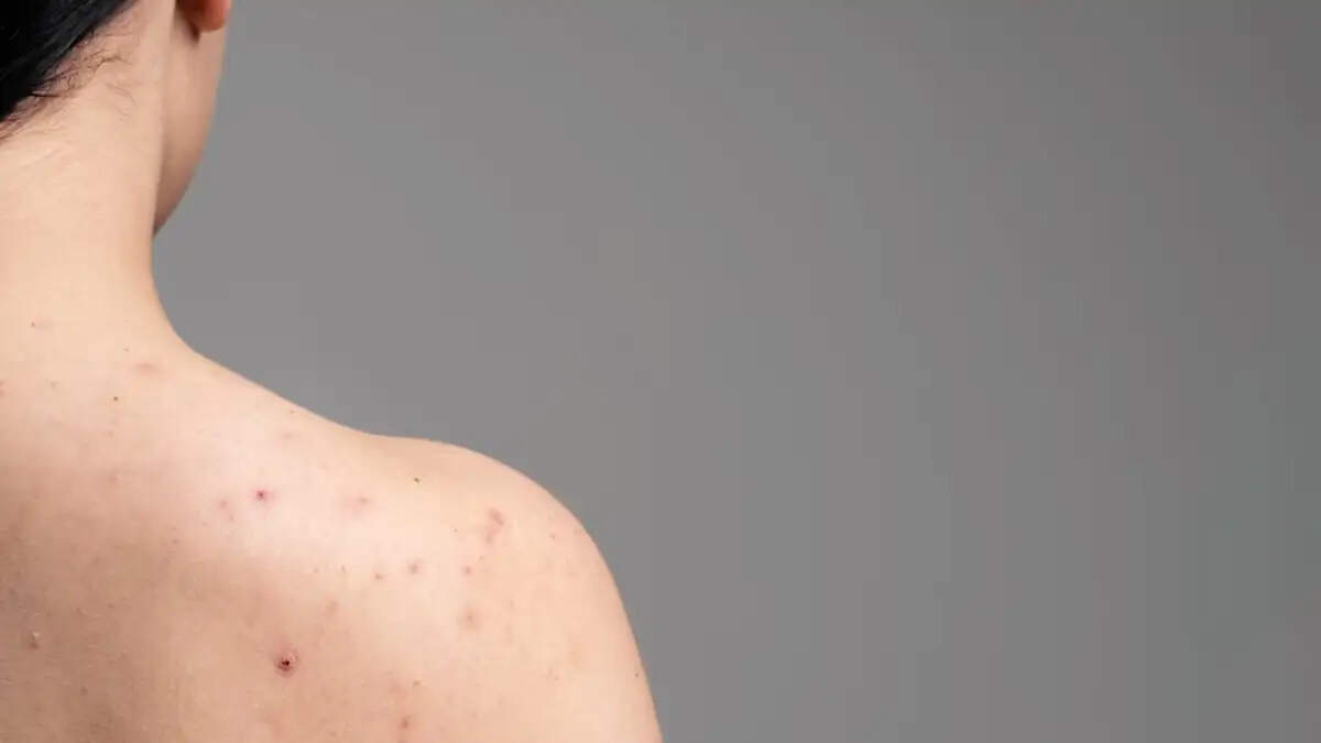Benefits of Showering Every Day: Don't Skip It!