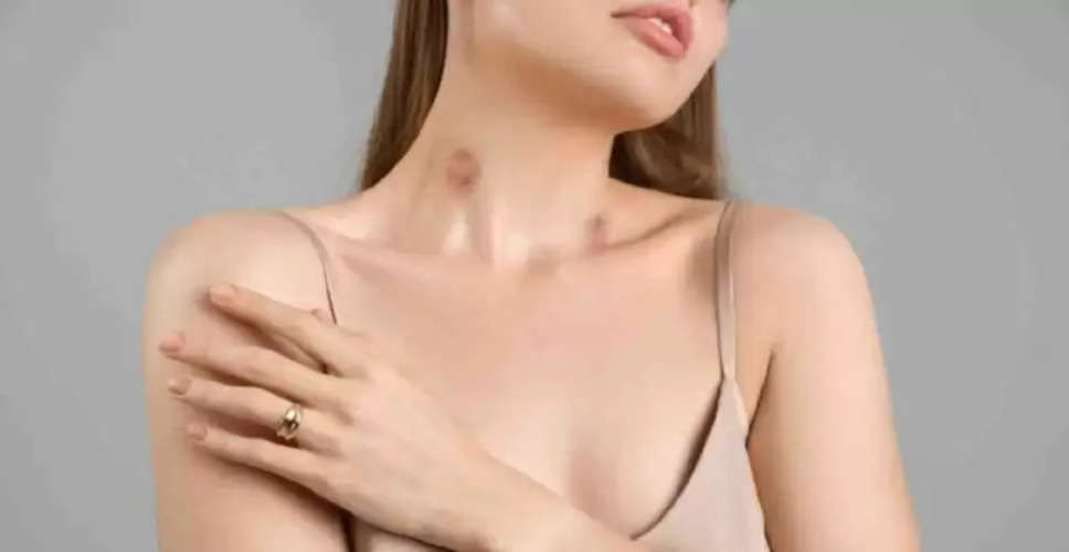 "Kiss Goodbye to Hickeys: Dermatologist-Recommended Methods for Quick Healing"